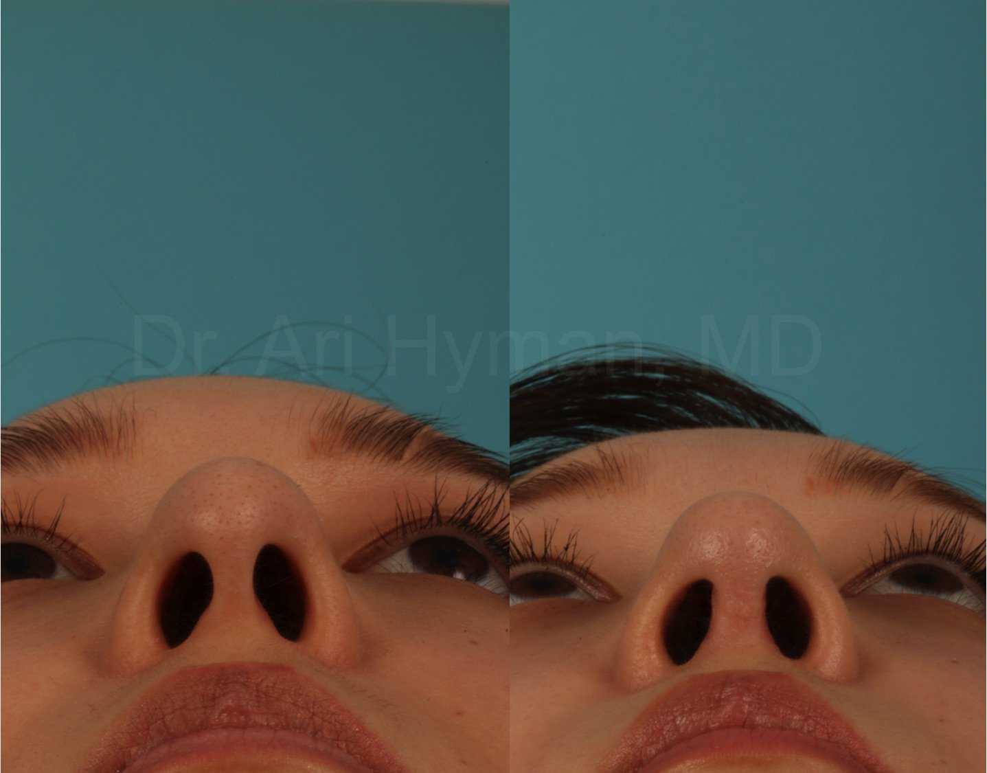 al6.jpeg
