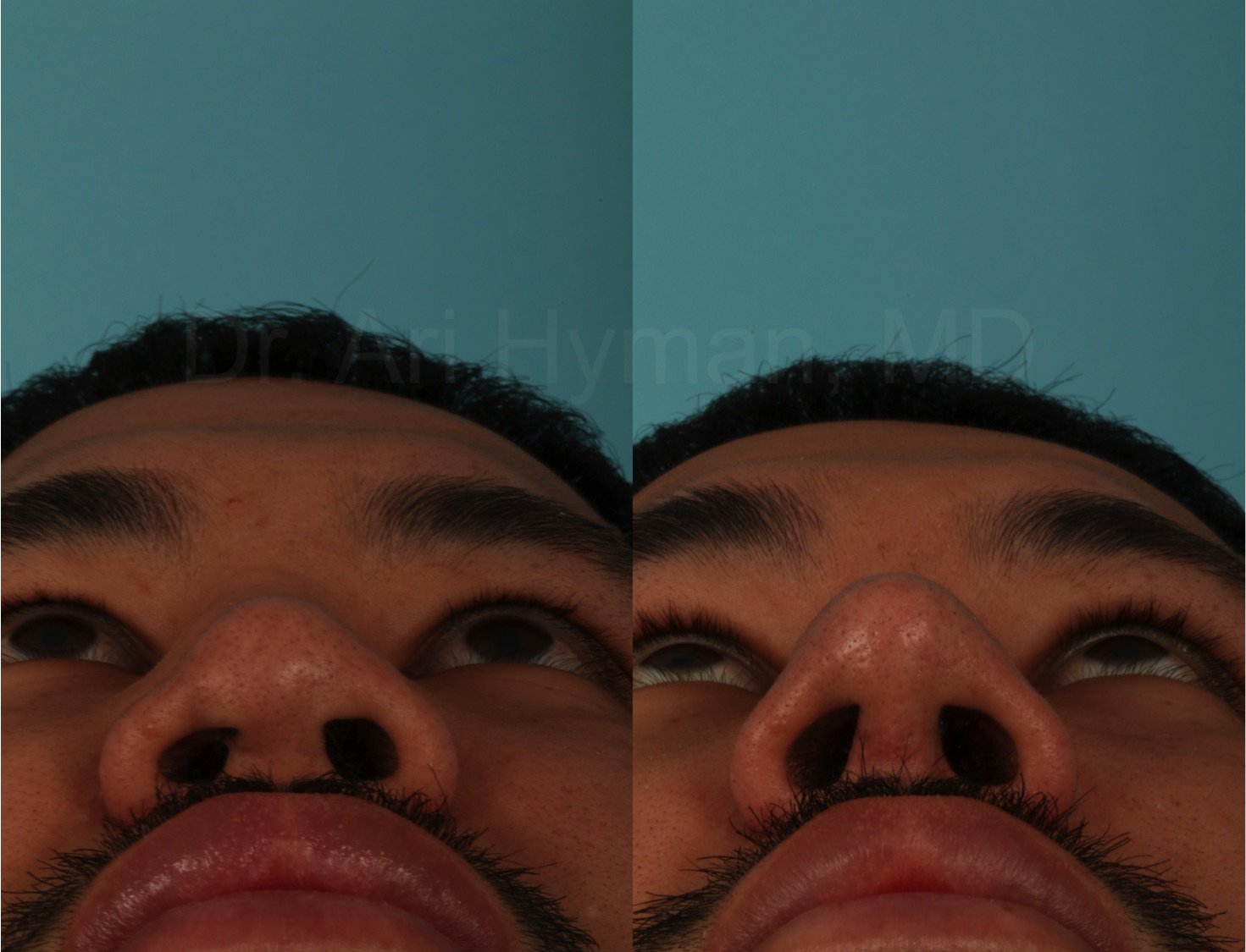 rdp6.jpeg