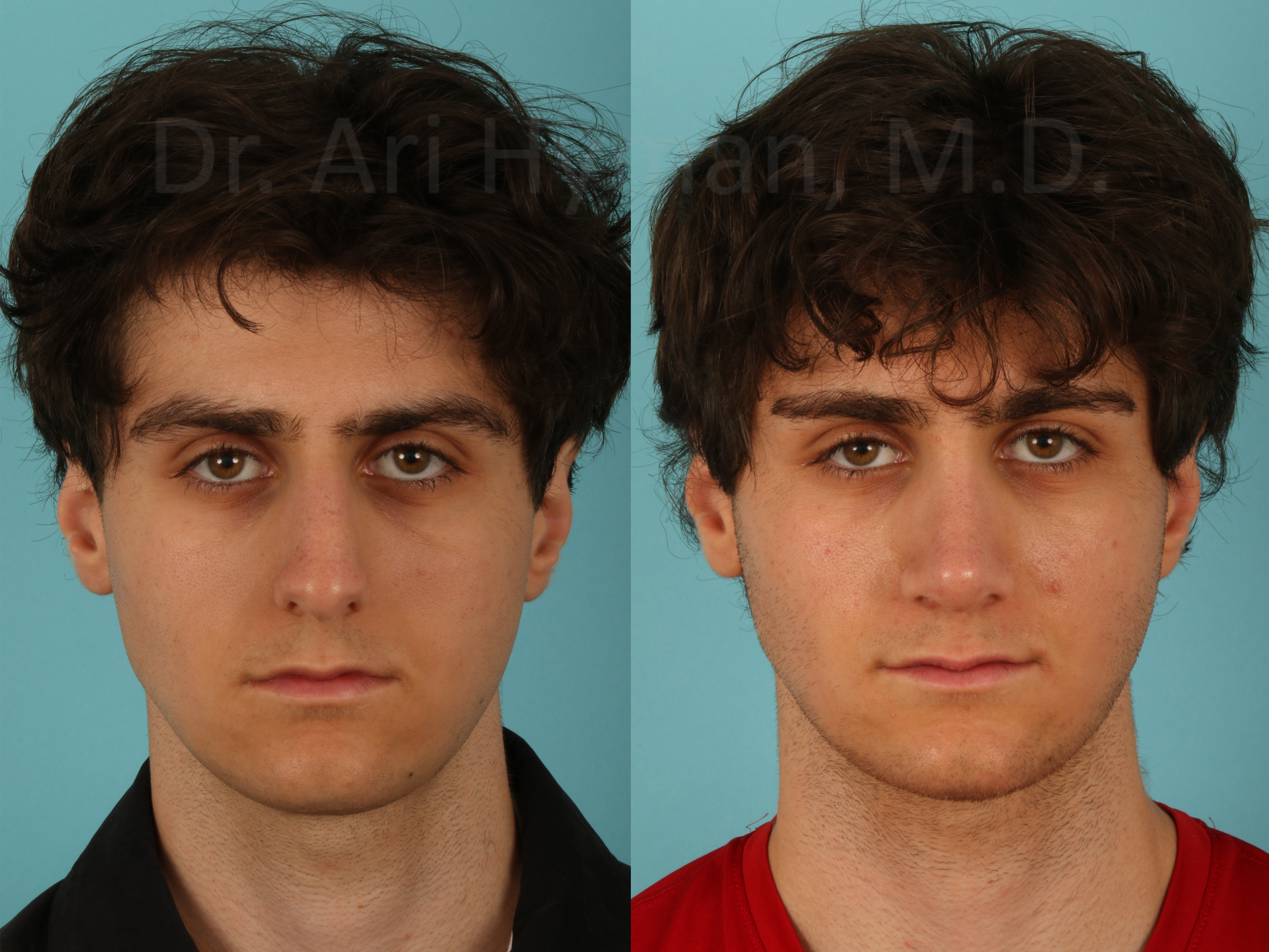 Picture21.png