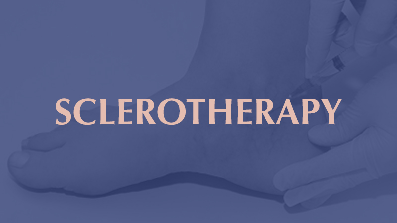 SCLEROTHERAPY SPECIALIST.jpg