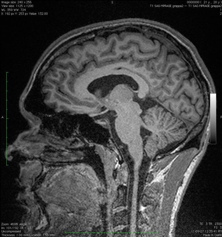 Brain.png
