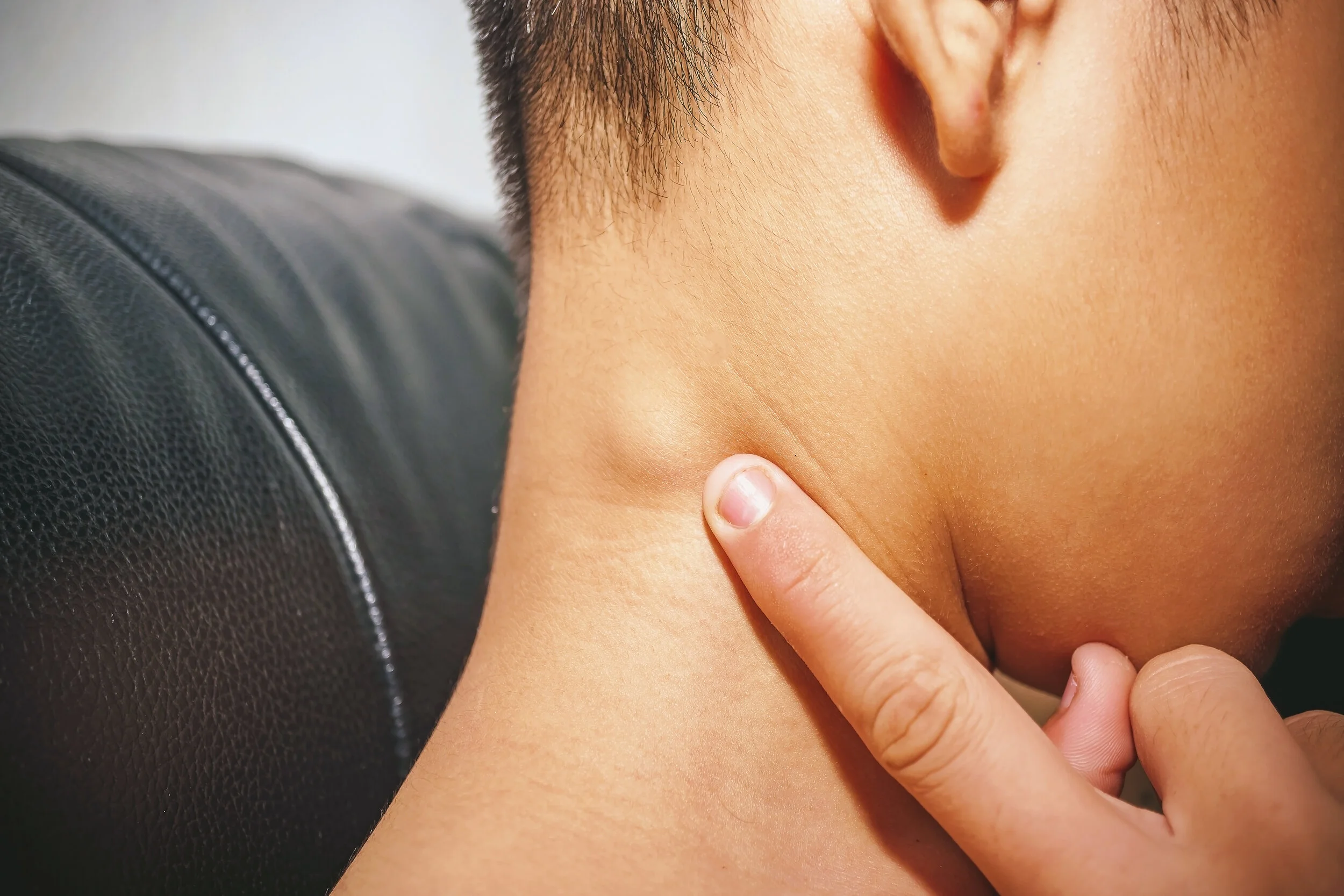 tumors-growths-and-lumps-of-the-head-and-neck-areas-doctorlansford