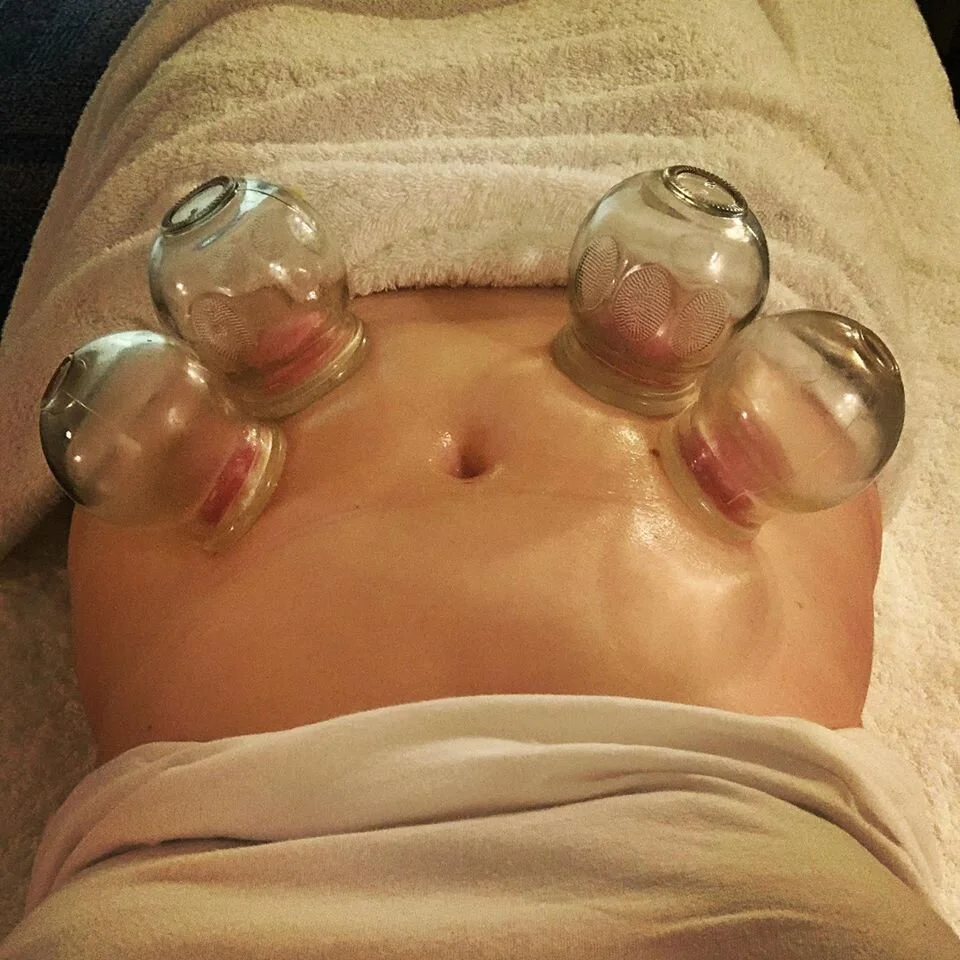 A Wellness Nest Woman appointment can incorporate tools such as cupping, dry needling, essential oils and crystals.