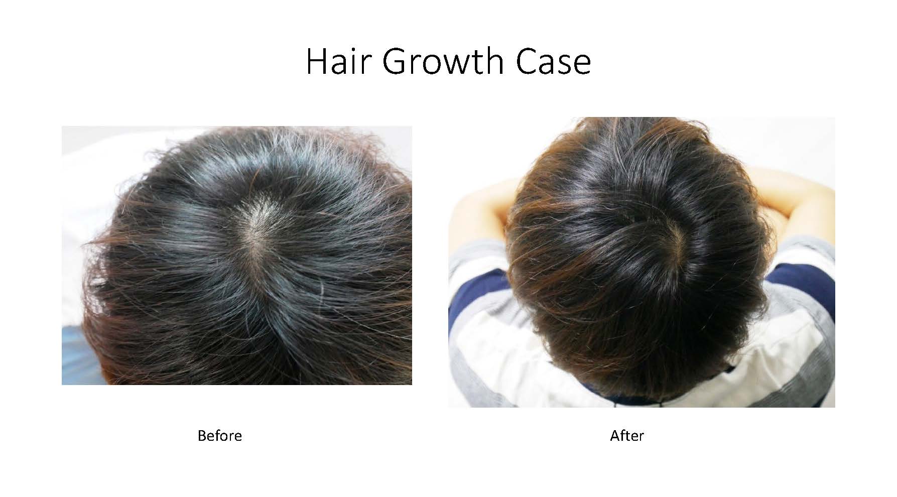 Hair growth examples_Page_3.jpg