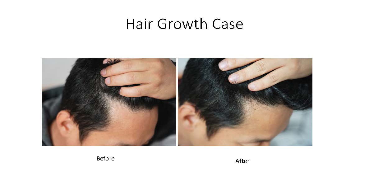 Hair growth examples_Page_4.jpg
