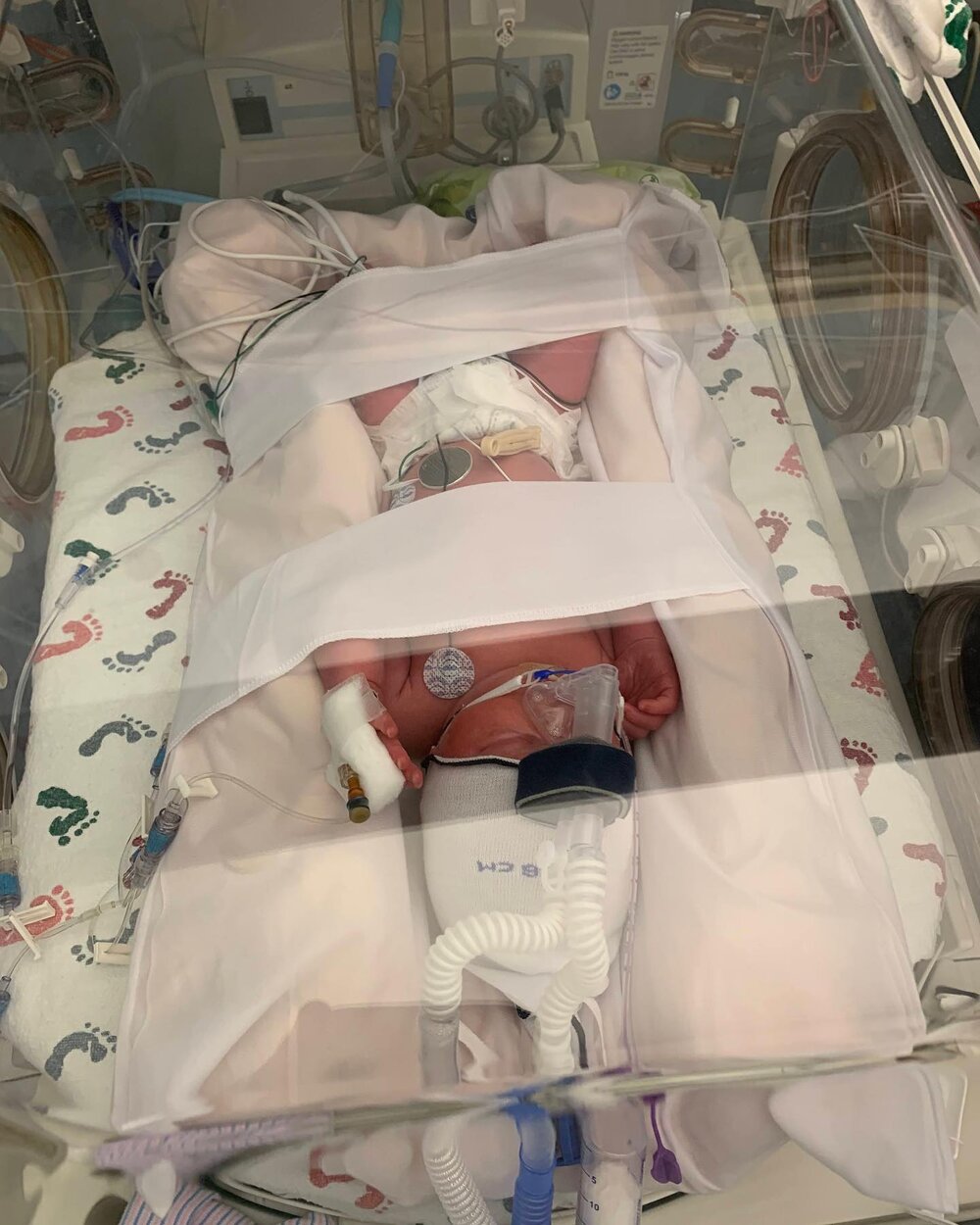 World Prematurity Day with our sweet preemie! 💙

Born at 32 weeks, our William was unable to breathe on his own, regulate his body temperature, or eat on his own. Our little NICU graduate conquered all of those skills in about 30 days! 

Now, he&rsq