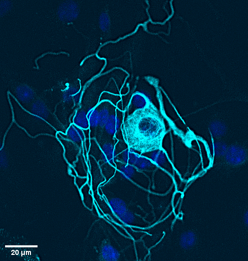 A trigeminal ganglion neuron from a primary culture preparation.