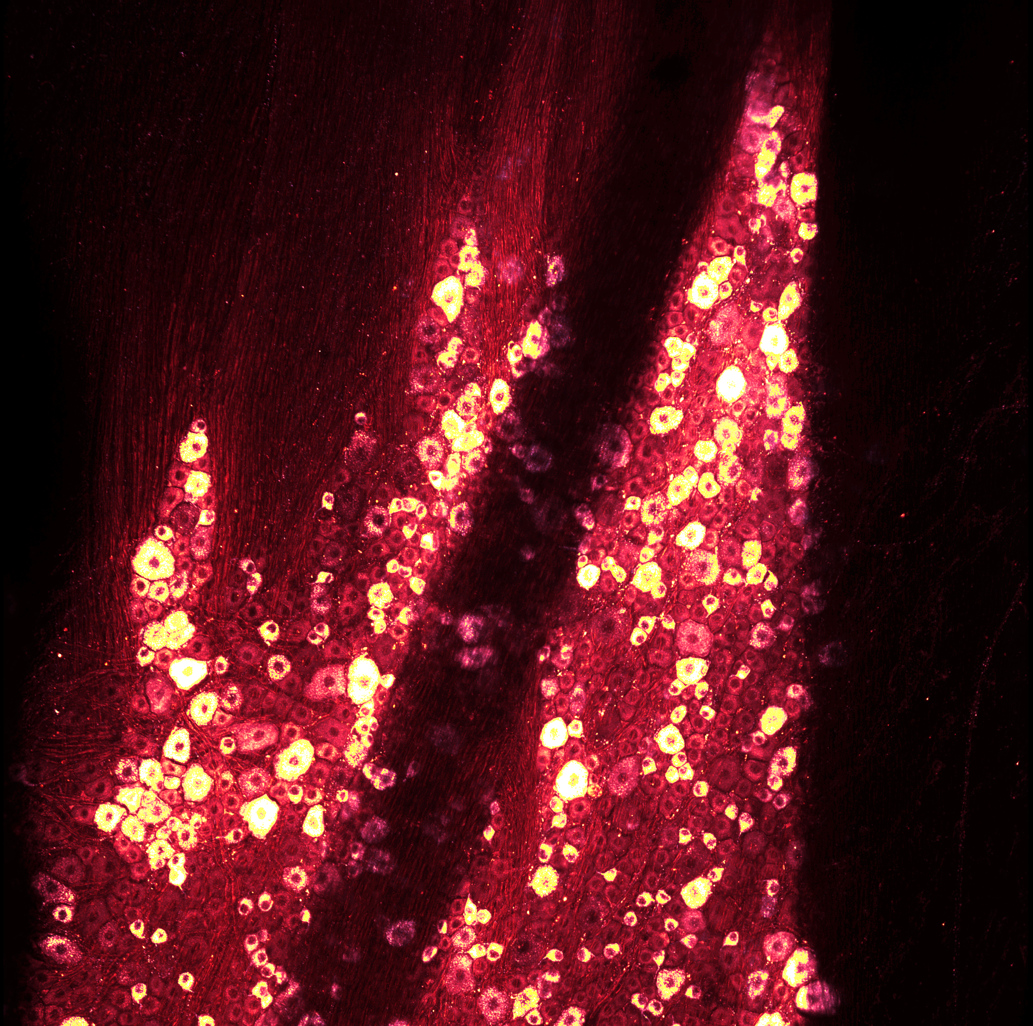 Trigeminal Ganglion neurons highlighted