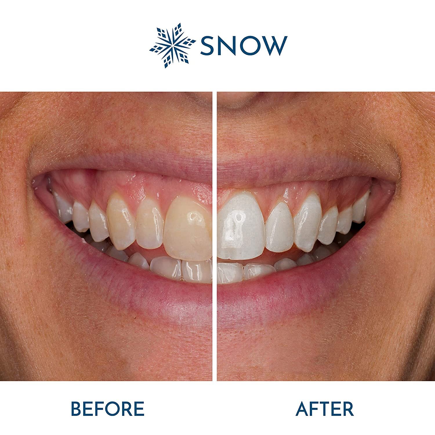 An Unbiased View of Existing Customer Promo Code Snow Teeth Whitening