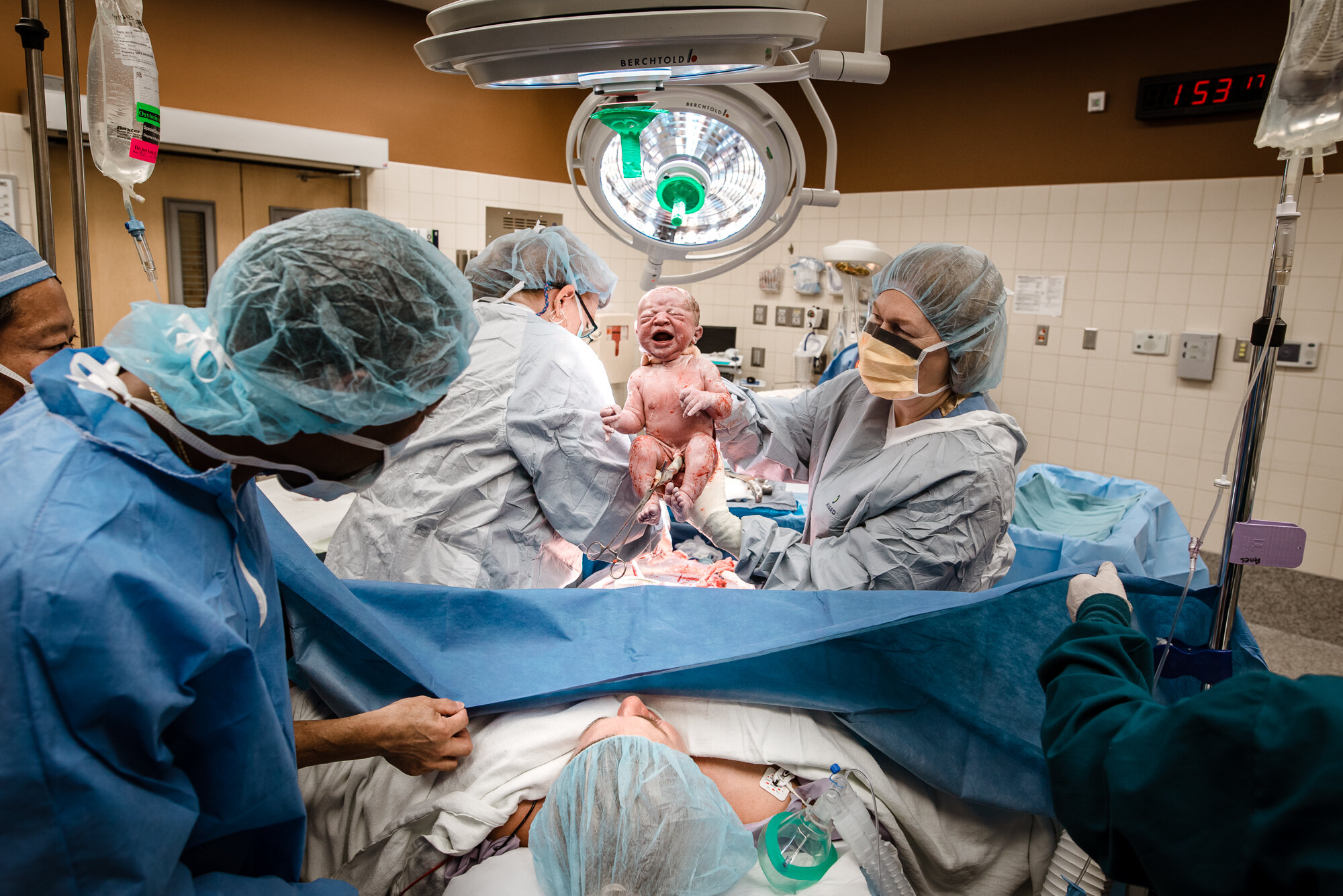 Cesarean Awareness Month: A Collection Of Images Featuring Planned and  Unplanned Surgical Births — Gather Birth Cooperative