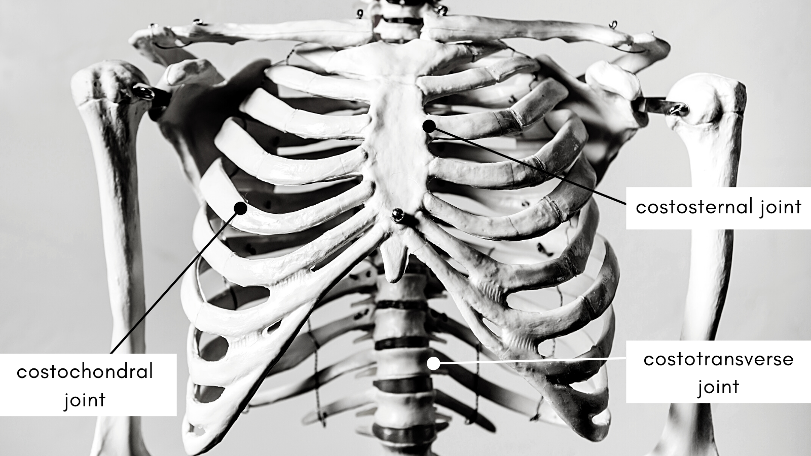 False Broken Ribs
