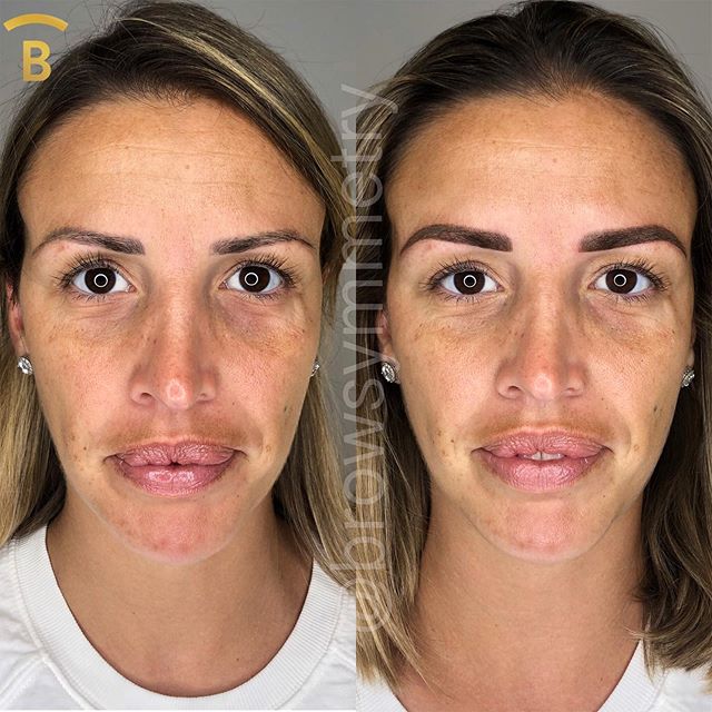 Powder ombr&eacute; brows to even out my client&rsquo;s previously tattooed brows (by another artist). Also, color corrected her bulbs (inner part of her brows) as her old tattoo healed a bit ashy. Love how they turned out! 💕
.
.
.
.
.
.
.
.
#before