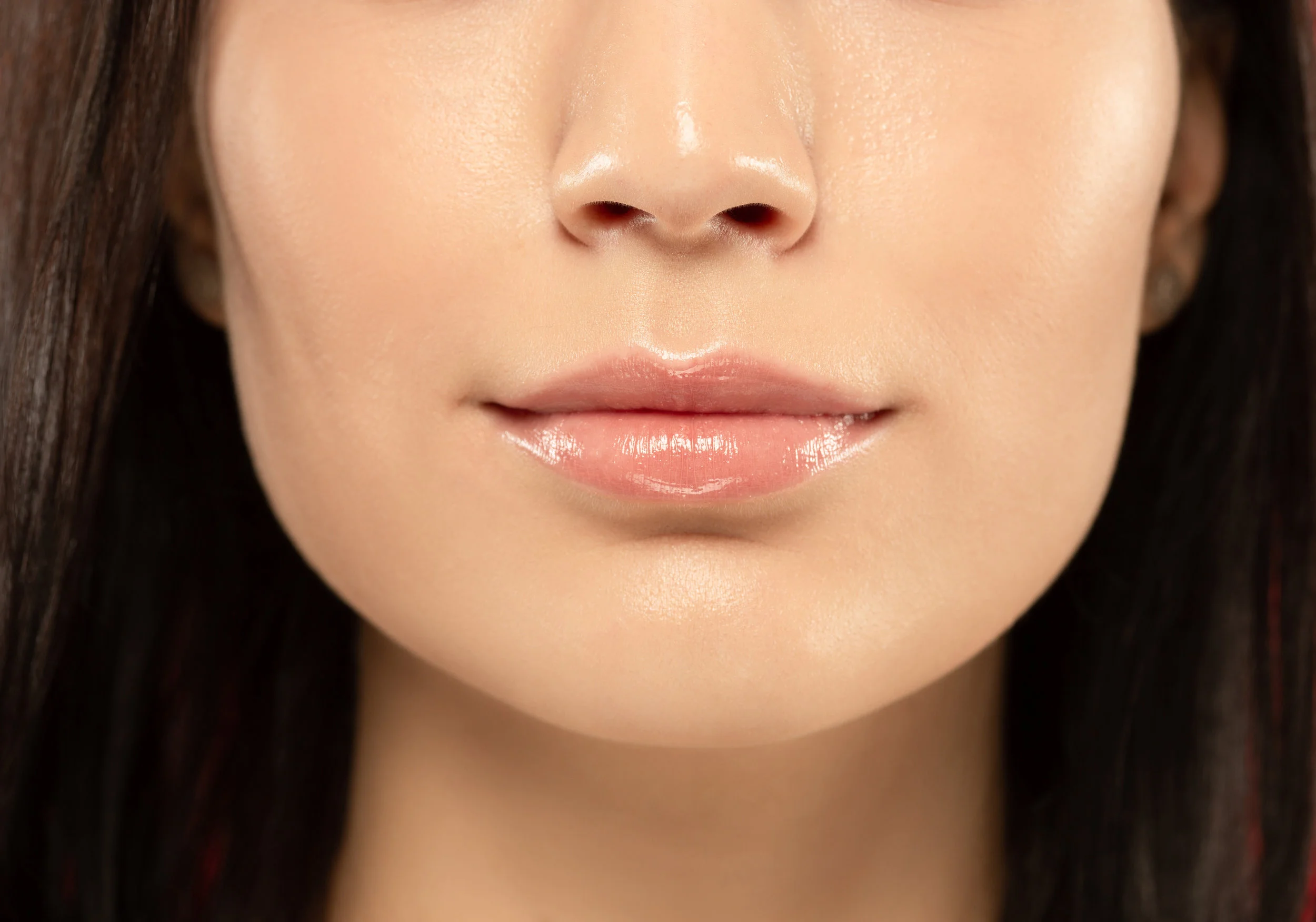 Cannula + Filler for Cheek Augmentation. Now FDA Approved.