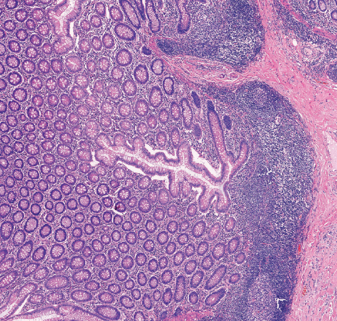 Email Nurture Campaign: Digital Pathology