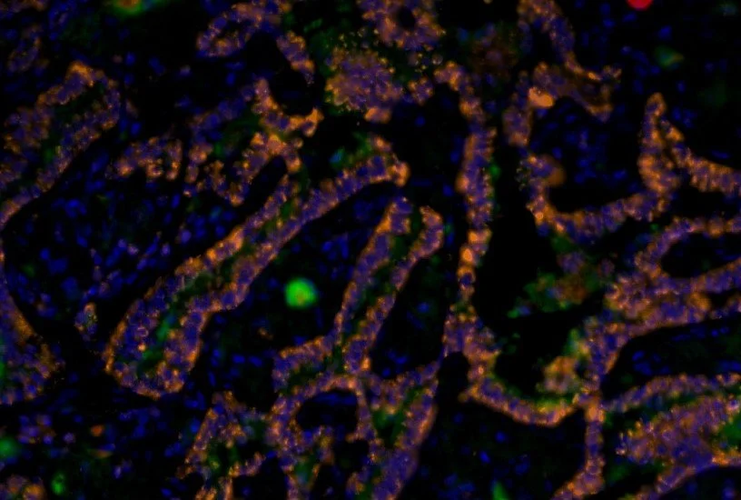 Marketing Campagin: Spatial Biology