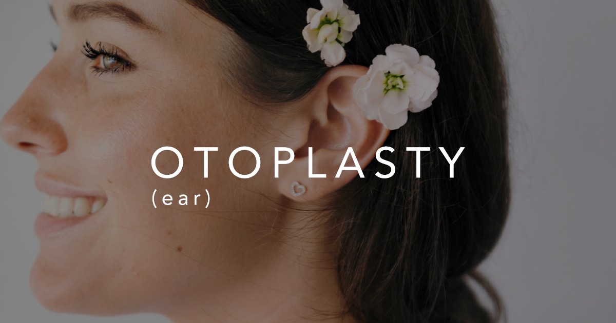 Otoplasty