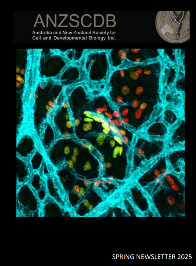 ANZSCDB Newsletter Spring 2025 - Cover.png