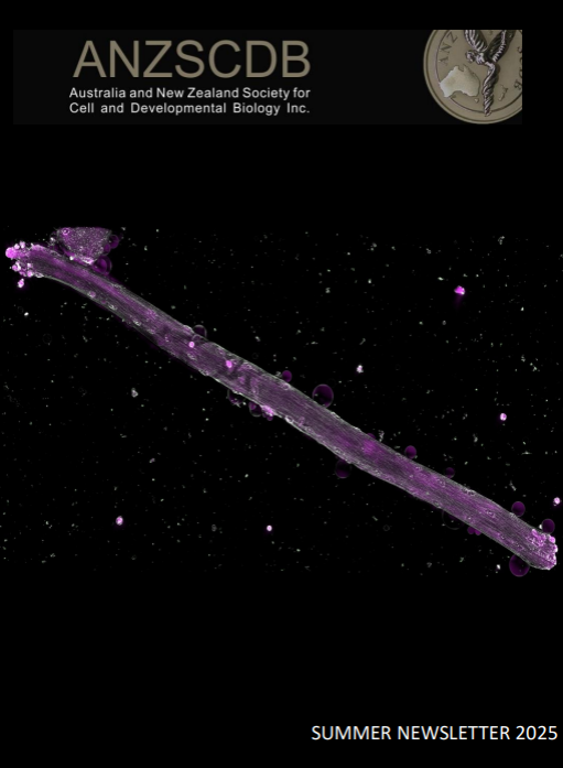 ANZSCDB Newsletter Summer 2025 - Cover.png