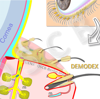 DEMODEX hair mites