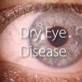 EYECARE HOME-Eng_LINK BILDCHEN_Dry Eye Disease_.jpg