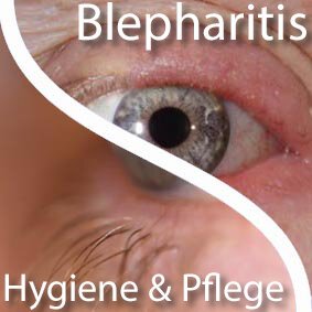 Blepharitis &amp; Lid Pflege