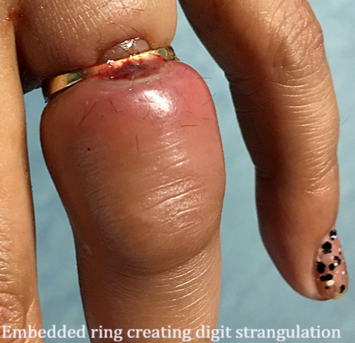 7 Finger Ring Stragulation c.jpg.png