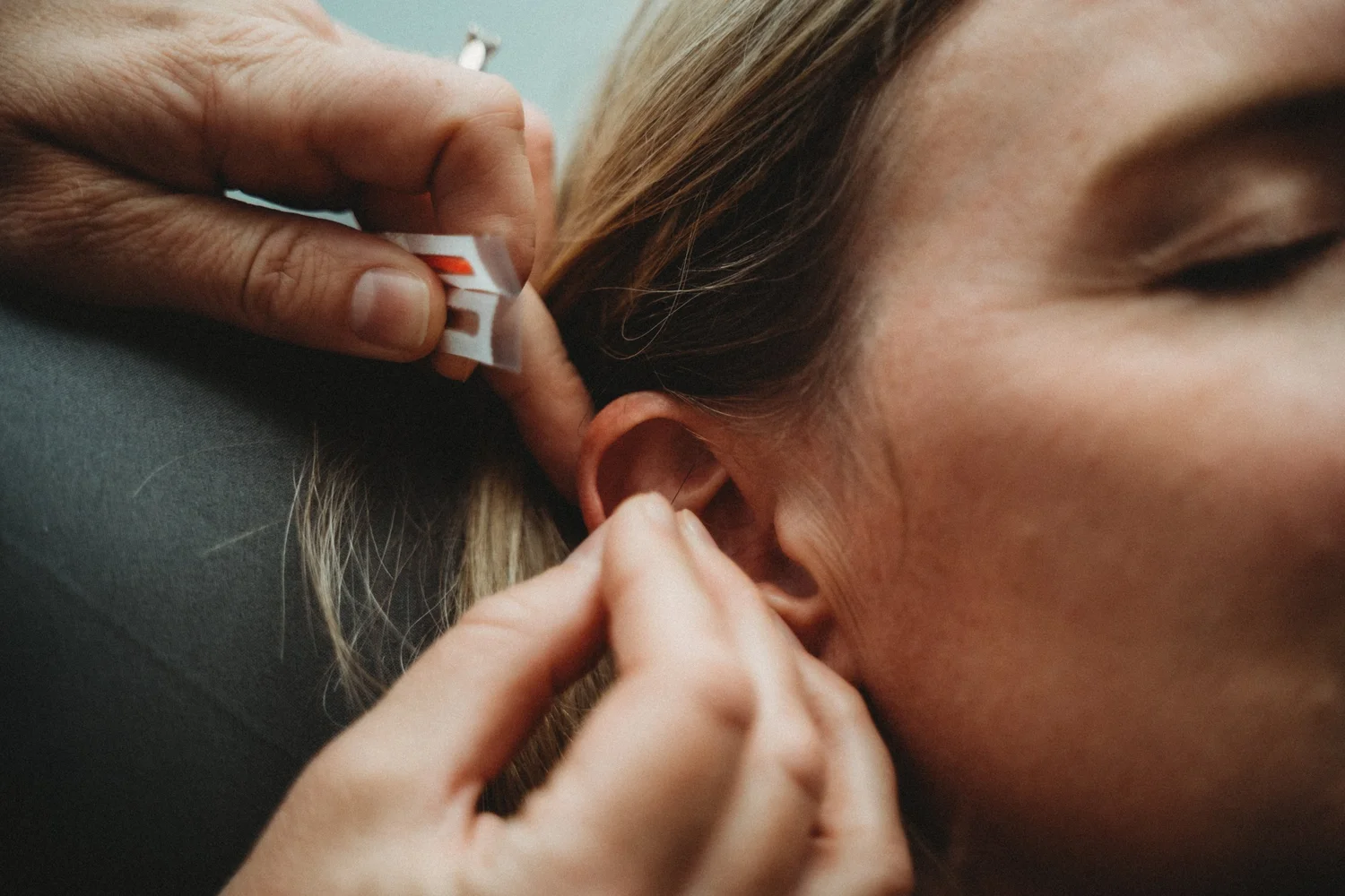 Quad Cities Acupuncture What to Expect — Peaceful Acupuncture