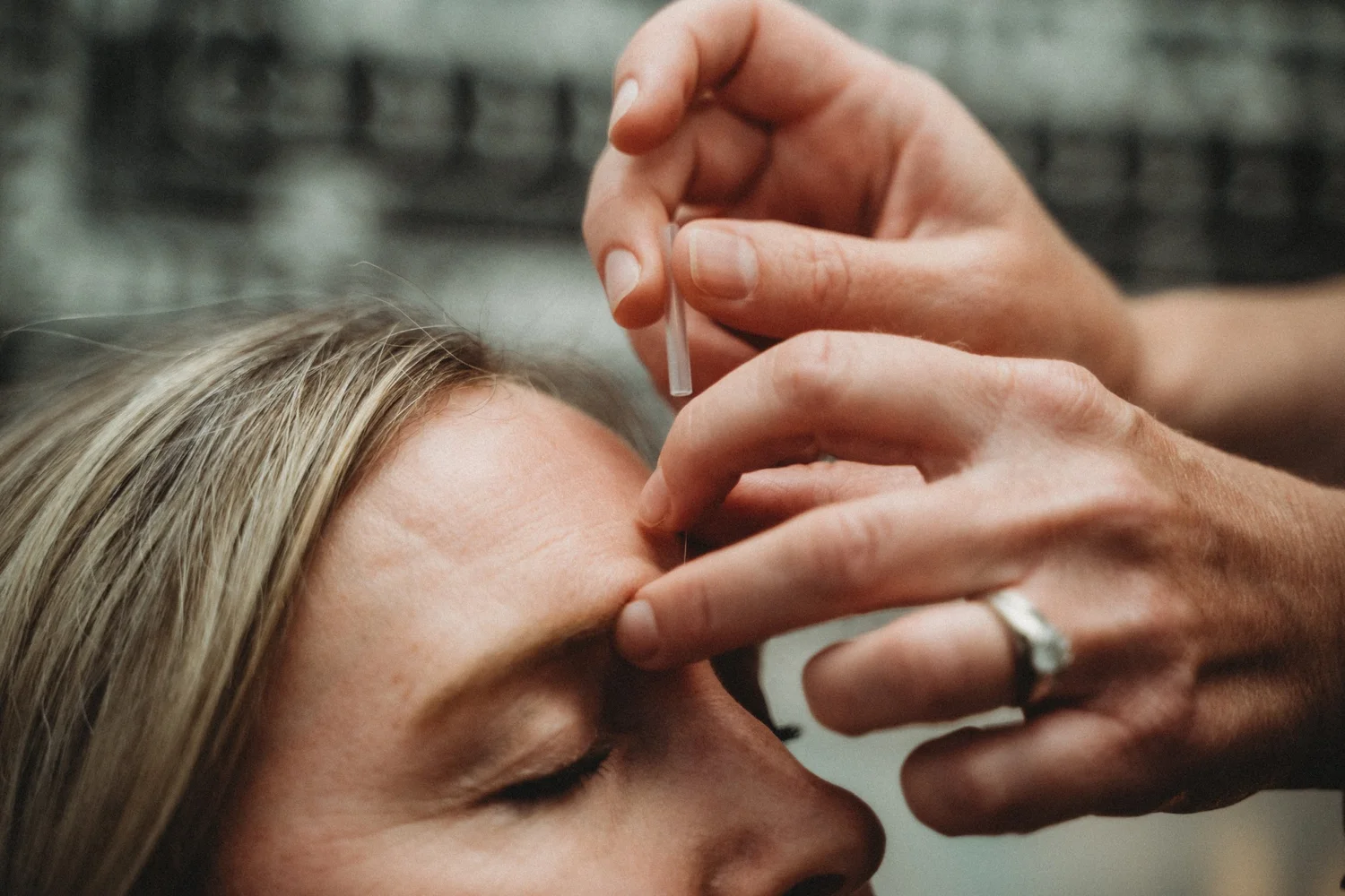 Quad Cities Acupuncture What to Expect — Peaceful Acupuncture