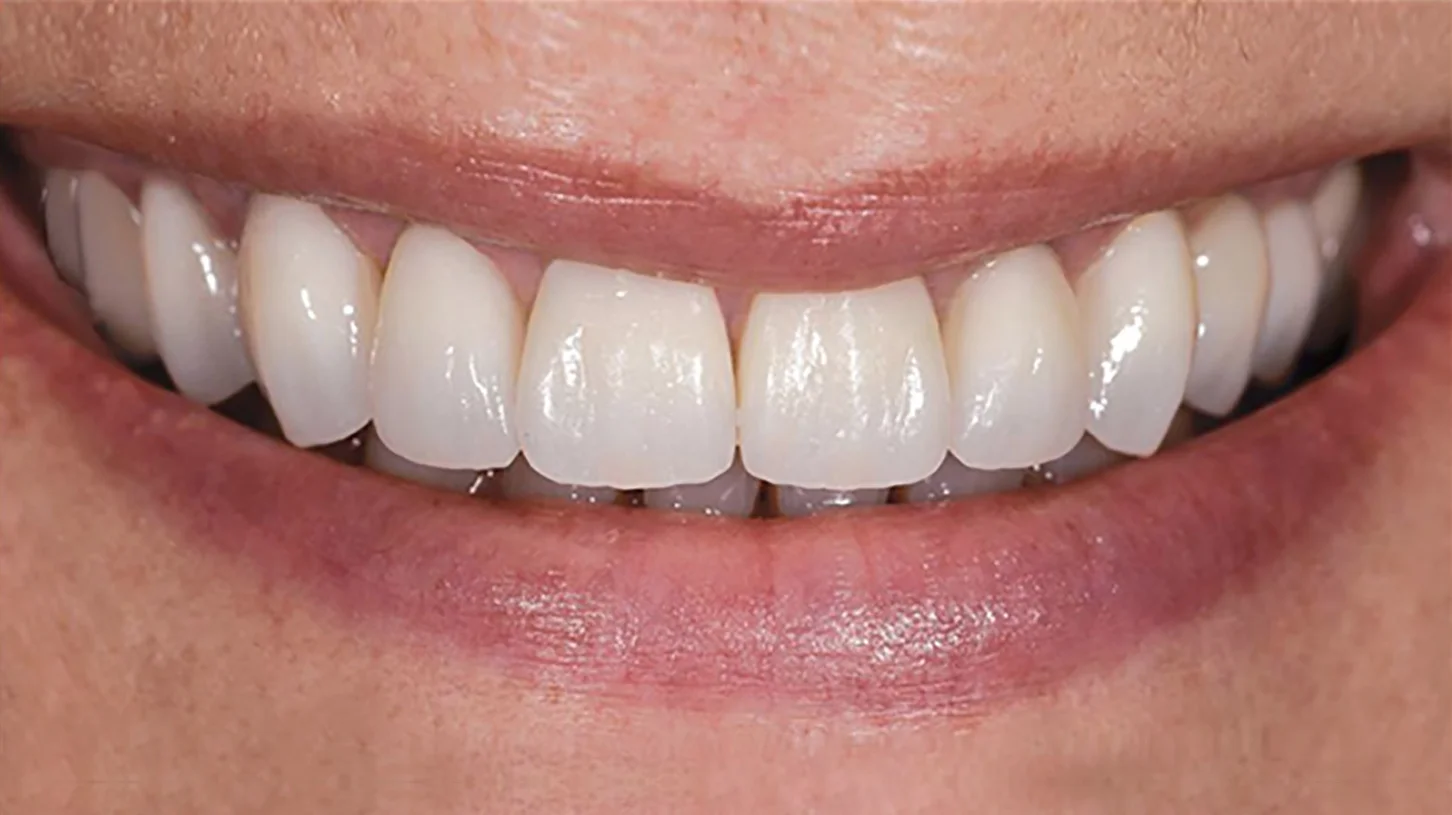 MicroDental_Prime_Stacey2.jpg
