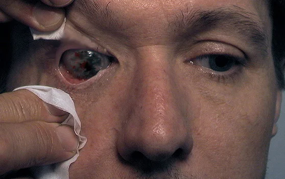 Hannibal_Verger Contact Lense Design.JPG