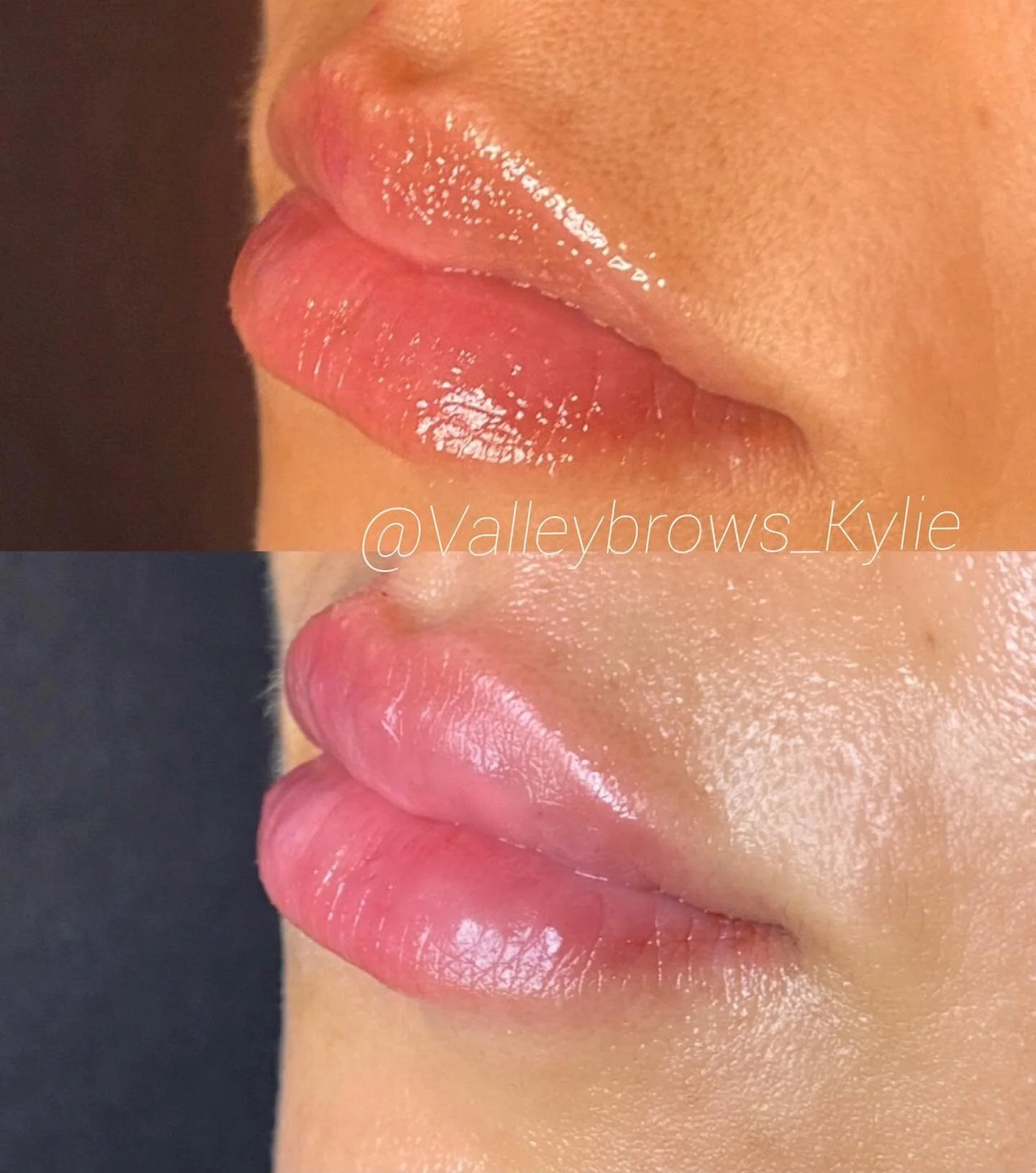 That perfect pout 💋 

#valleybrows #valleybrowskylie #valleybrowssonoma #lipfiller#needlefreeinjection #hayapen #lips #naturalfiller #sonoma #sonomacounty #napa #la #sanfrancisco #sandiego #bayareafiller #bayarea #lipslipslips