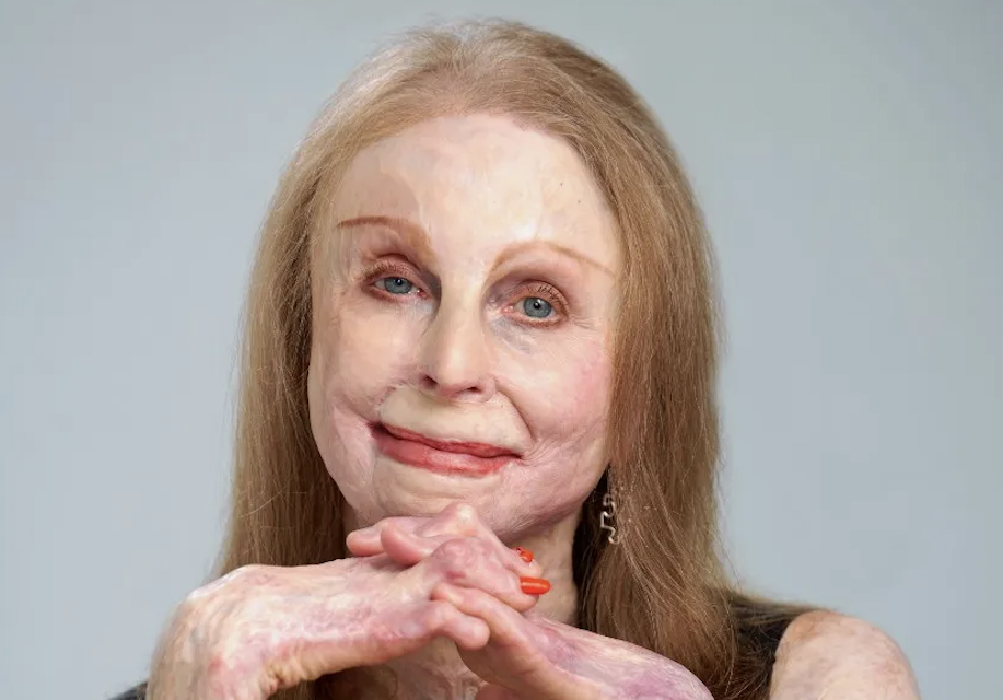 Charlene Pell - Facing forward in this altered body episode artwork