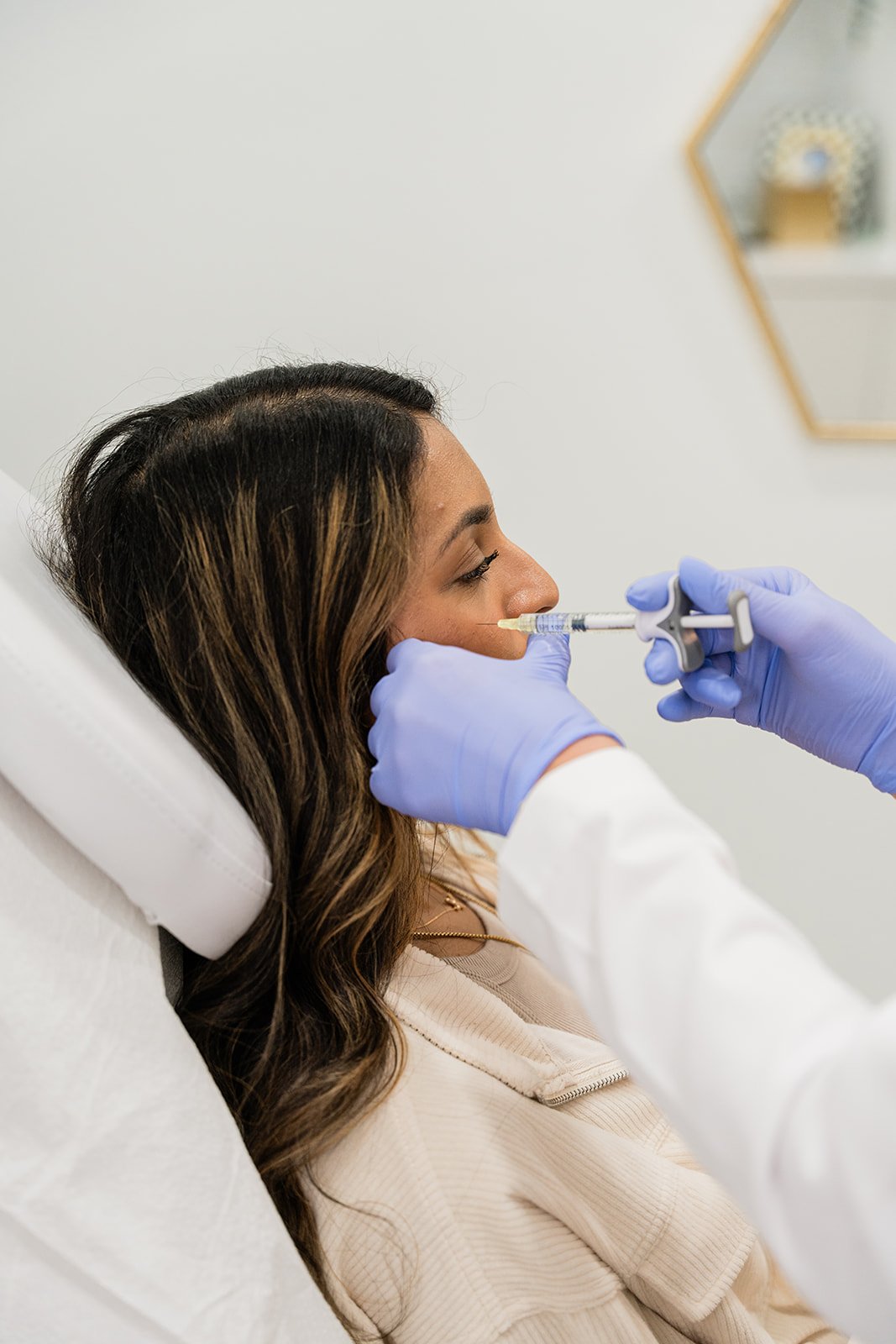Midface Lift - Filler