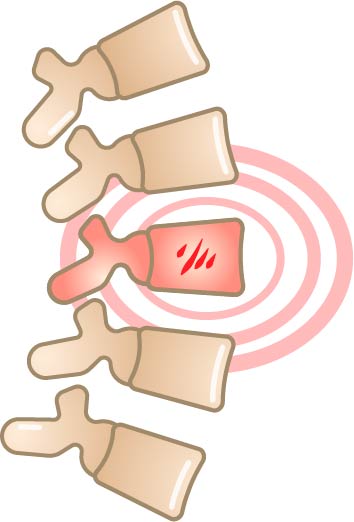 Spine.jpg
