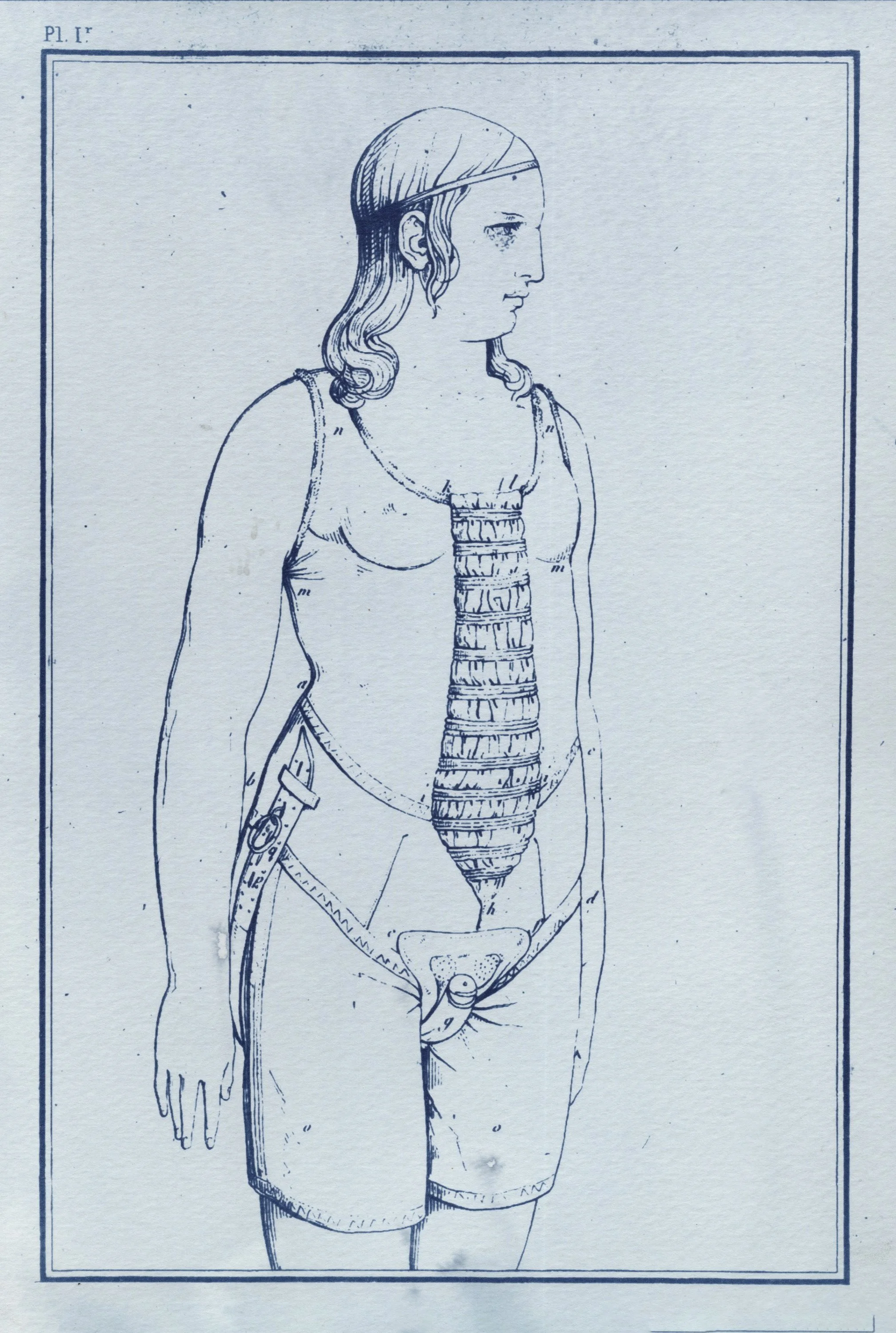 Unique cyanotype using original digital image: Considérations sur les hernies abdominales, sur les bandages herniaires rénixigrades et sur de nouveaux moyens de s'opposer à l'onanisme / [Guillaume Jalade-Lafond]. Wellcome Collection. Source: Wellcome