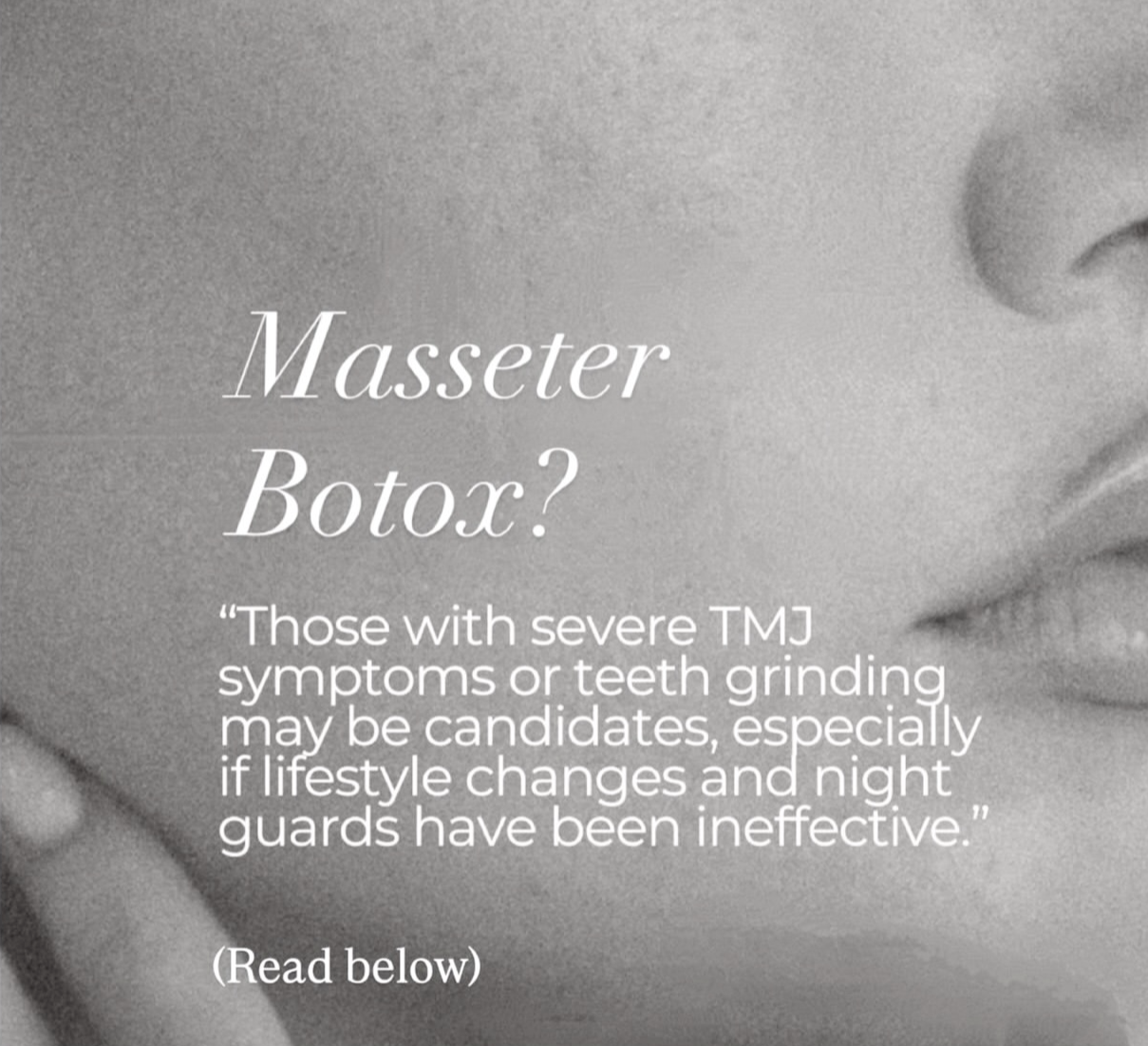 Considering Botox To Help With TMJ Dysfunction? Read This First