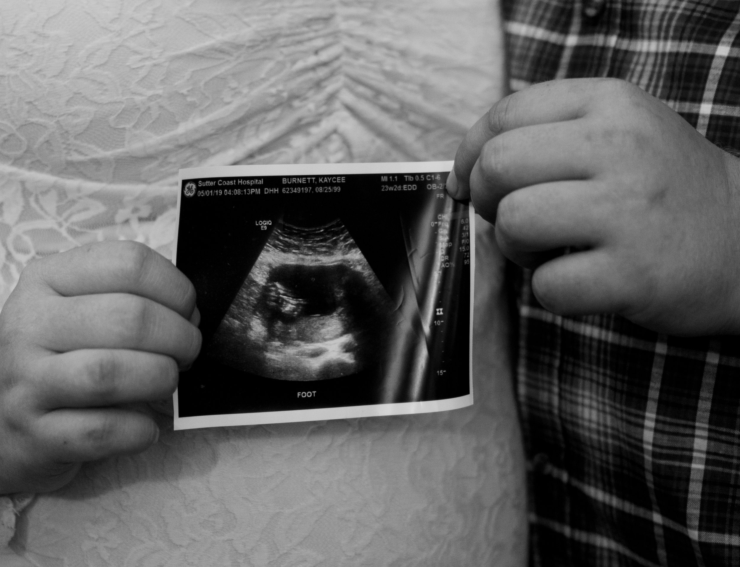 KBurnettMaternity2019-5.jpg