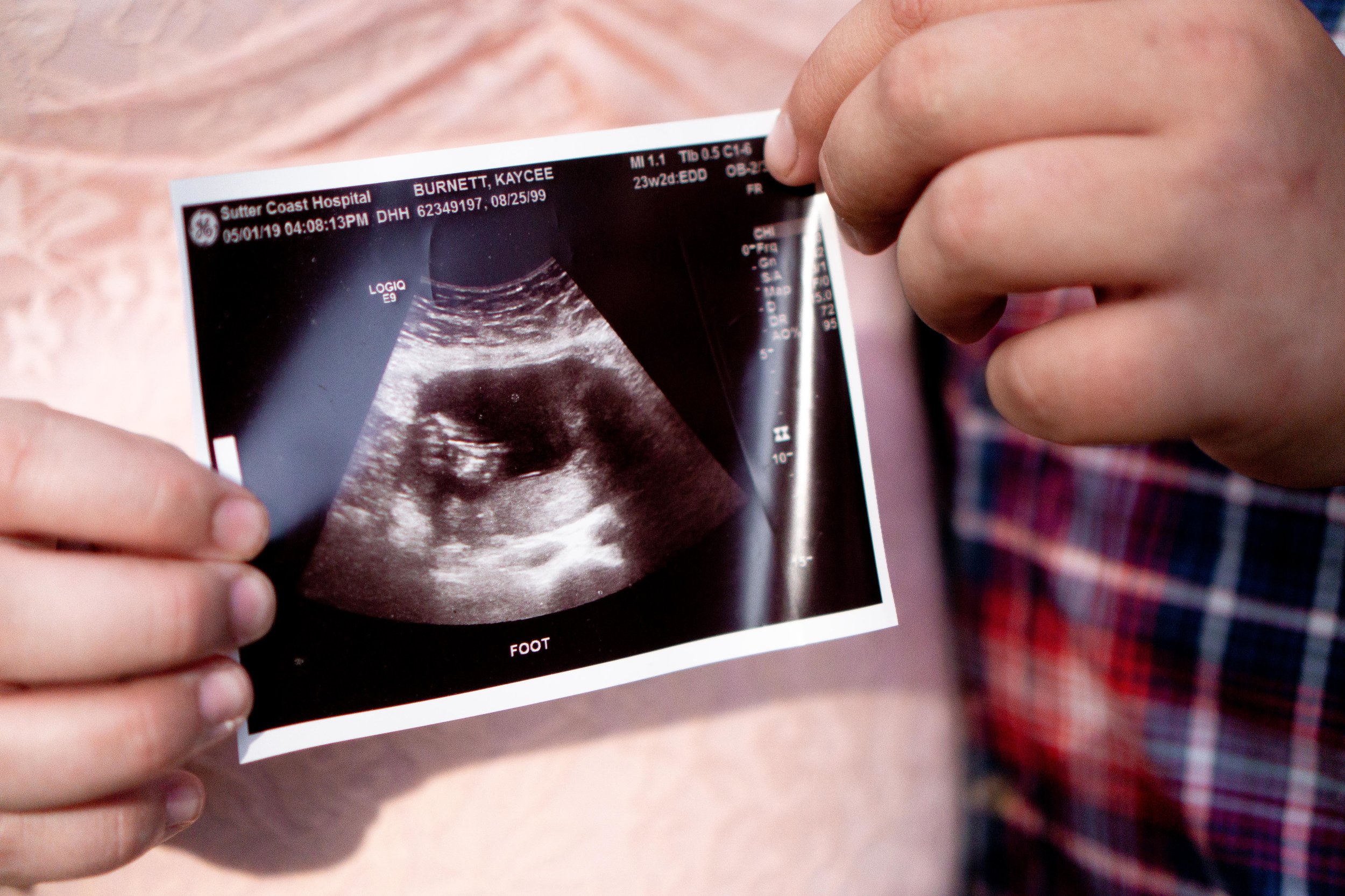 KBurnettMaternity2019-7.jpg