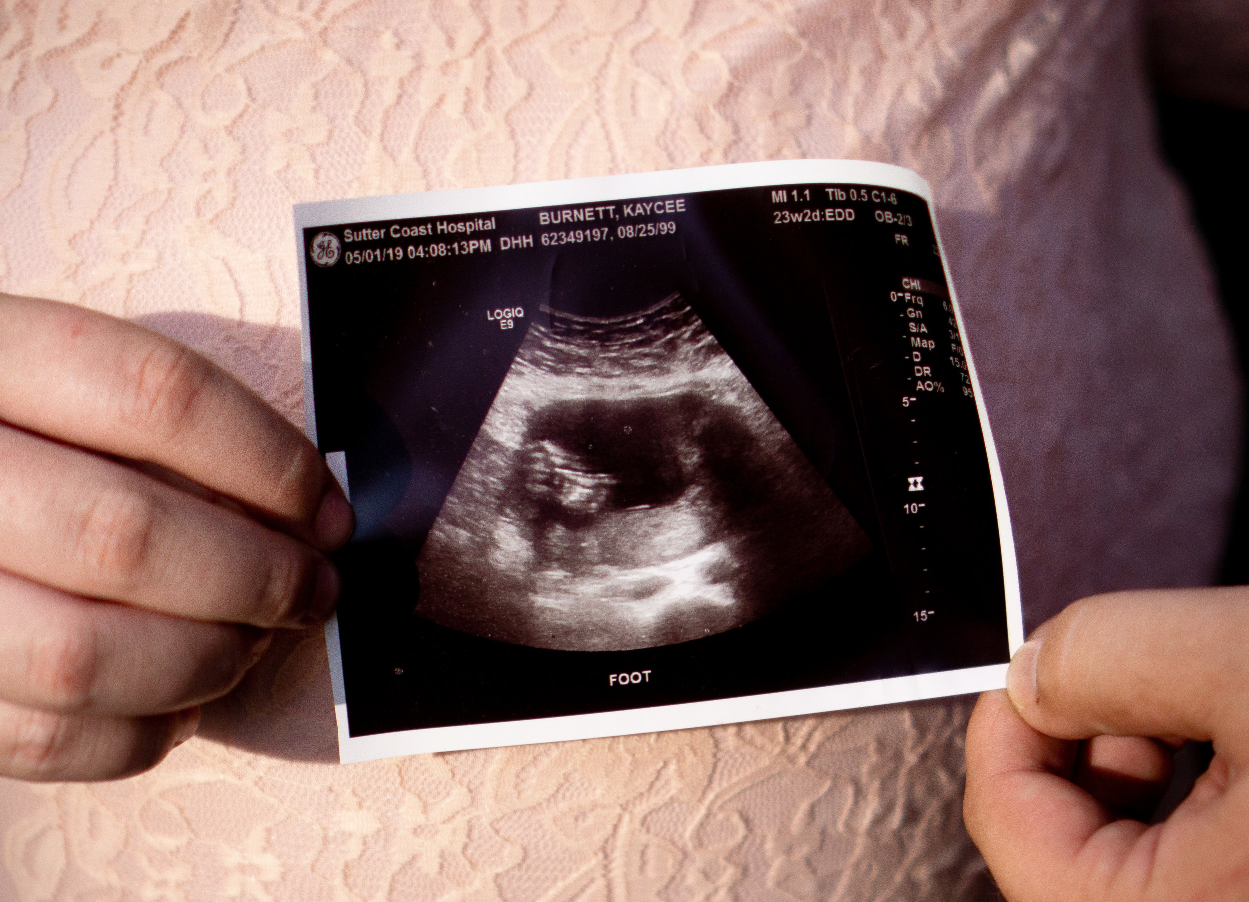 KBurnettMaternity2019-9.jpg