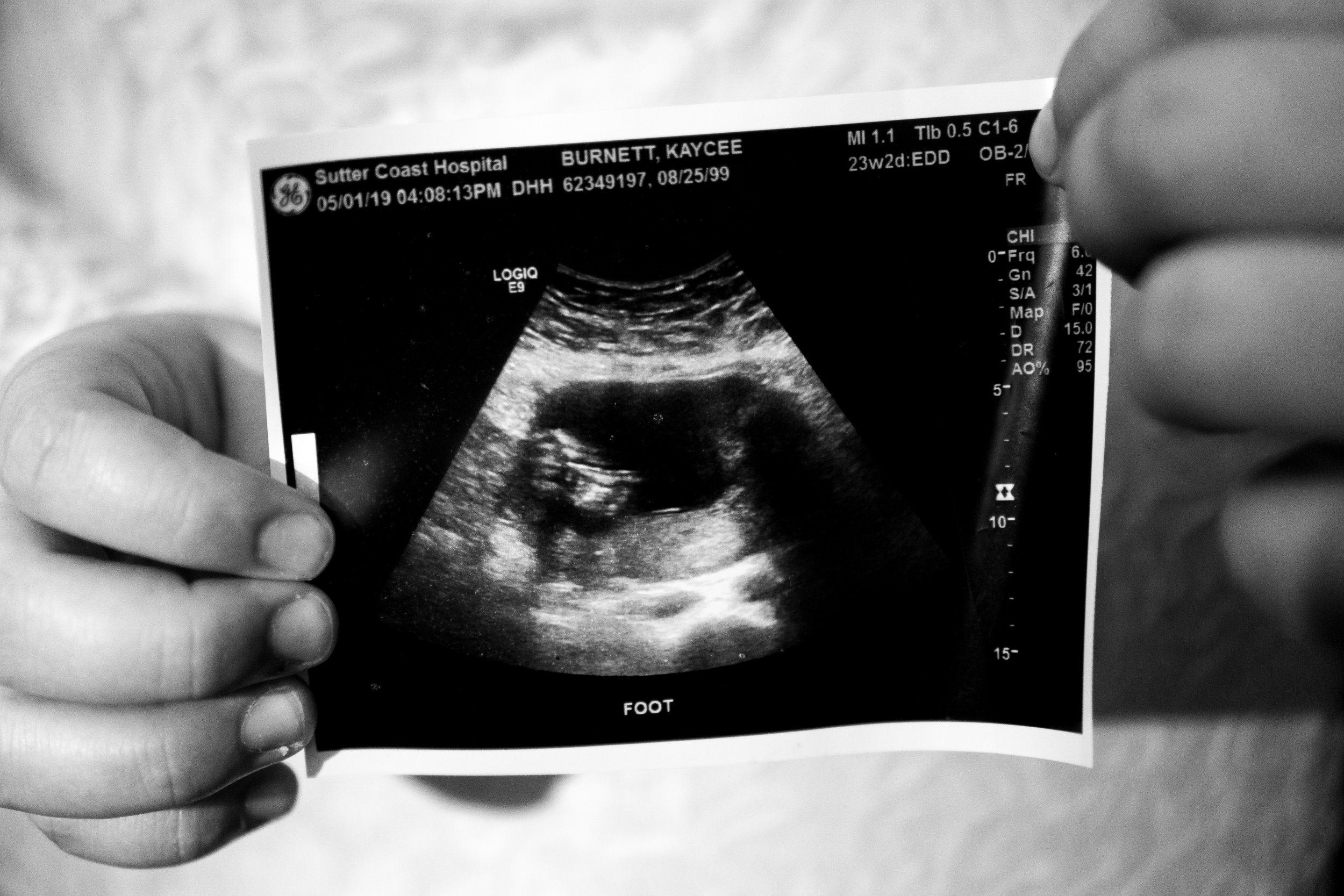 KBurnettMaternity2019-8.jpg
