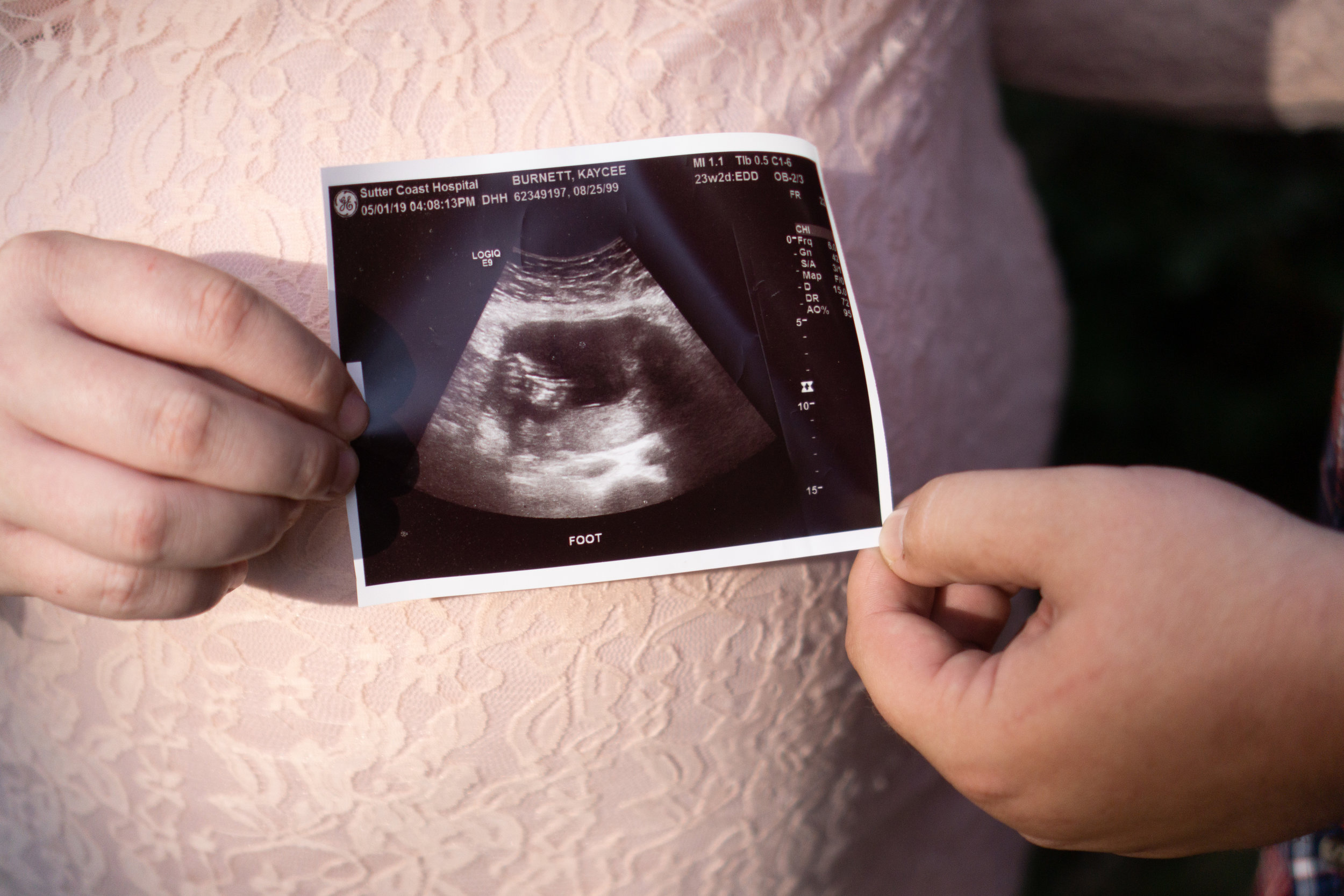 KBurnettMaternity2019-10.jpg