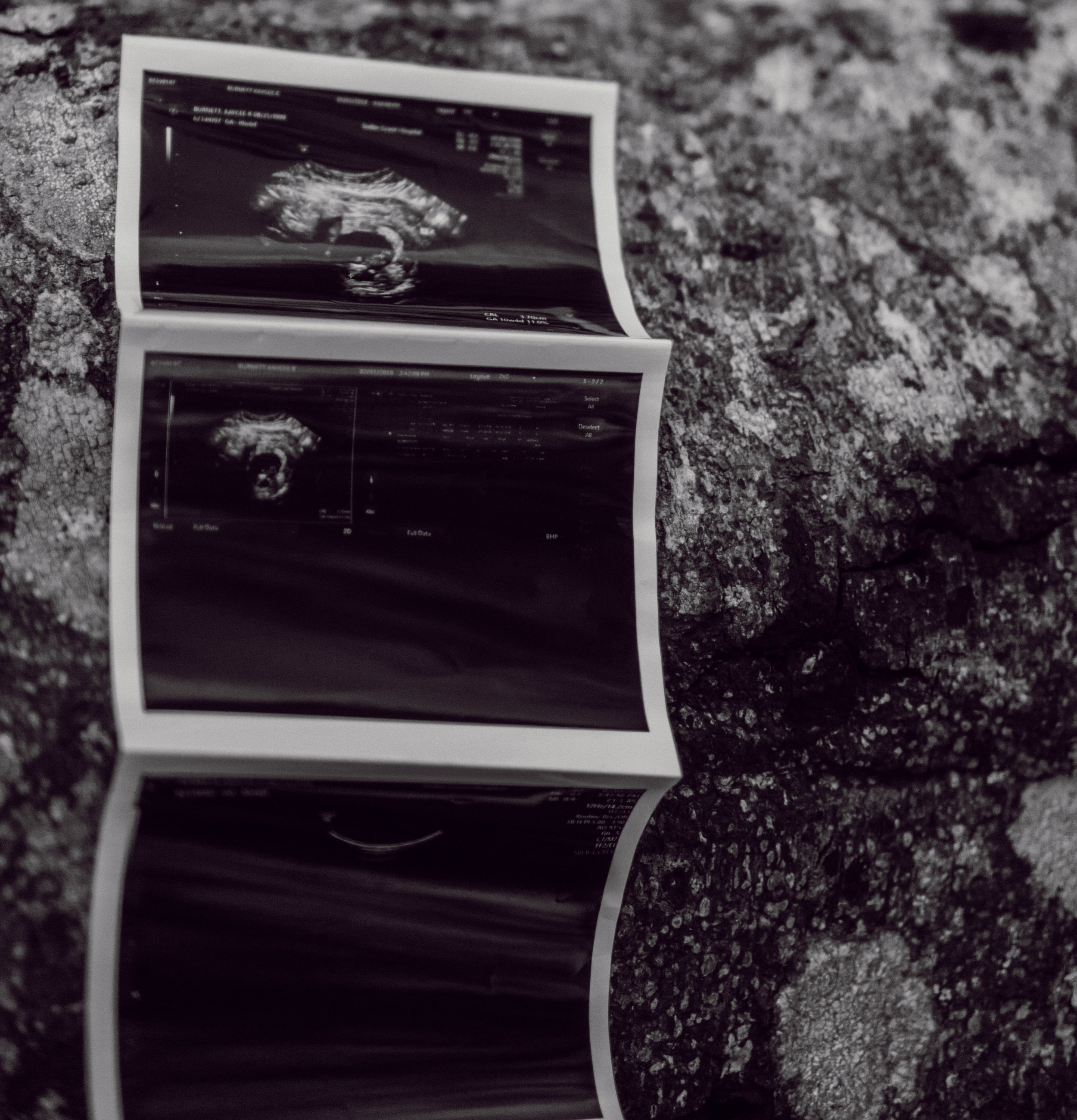 KBurnettMaternity2019-27.jpg