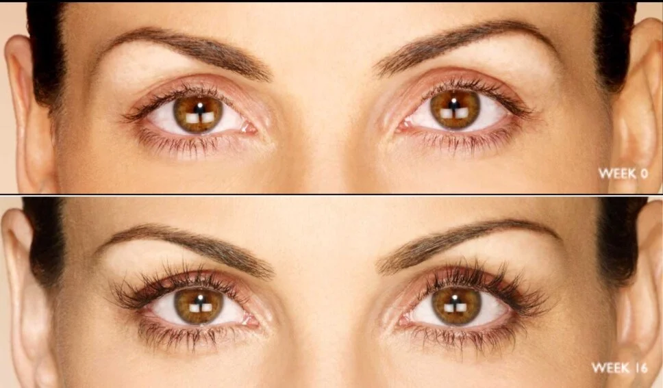 Latisse®: How to Apply and Maintain Your Lashes