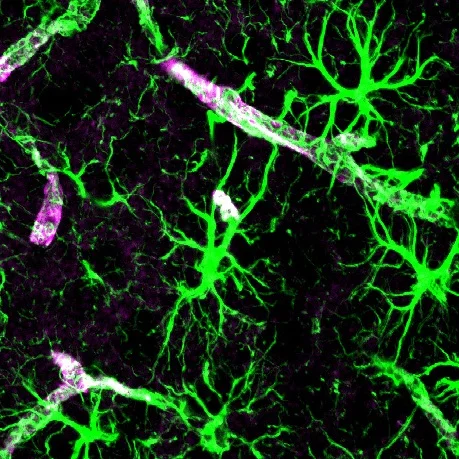 Astrocytes.jpg