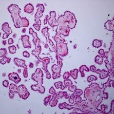 Choroid_Plexus_Histology_40x.jpg