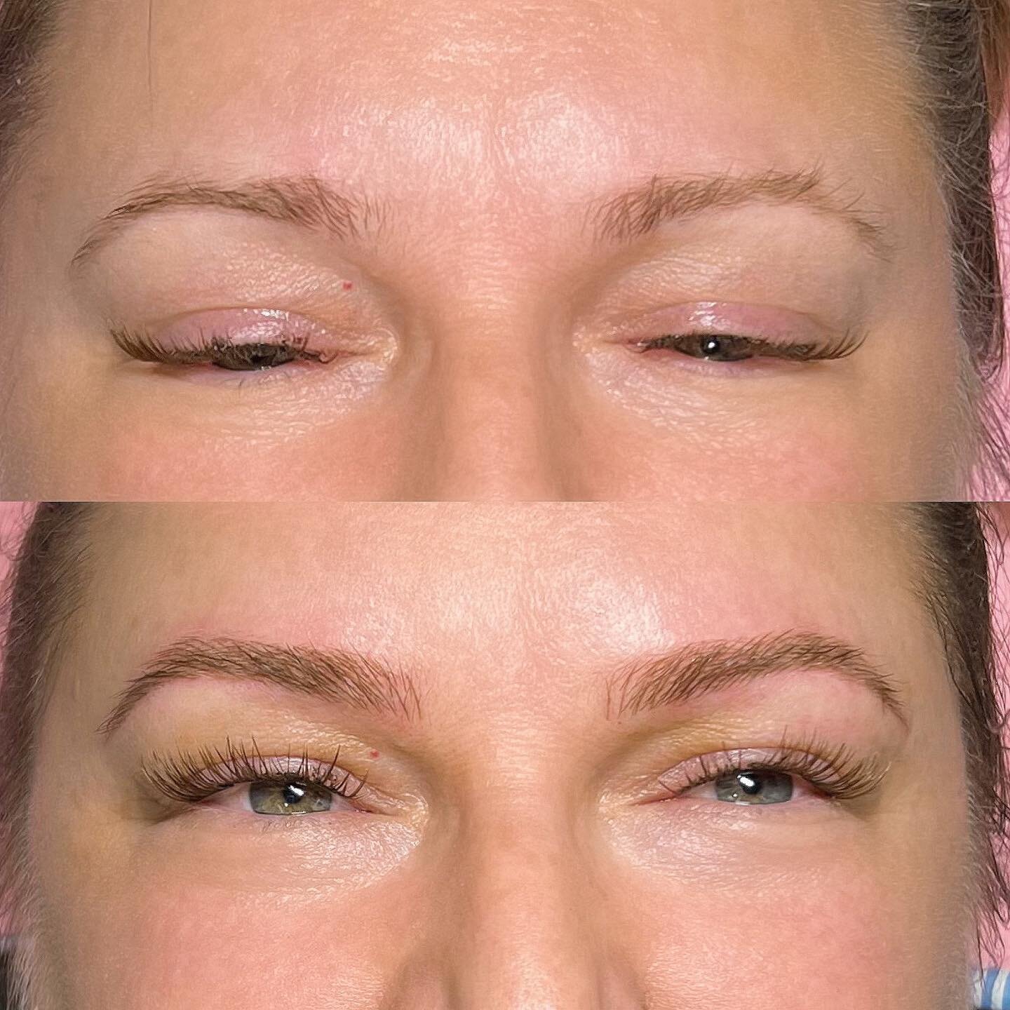 No harsh fronts here! The goal was small and subtle. We call it Microblading but it is truly Nanoblading. The needles in the nanoblades we use have a much smaller diameter to create the thinnest strokes possible. So if a soft natural brow is what you