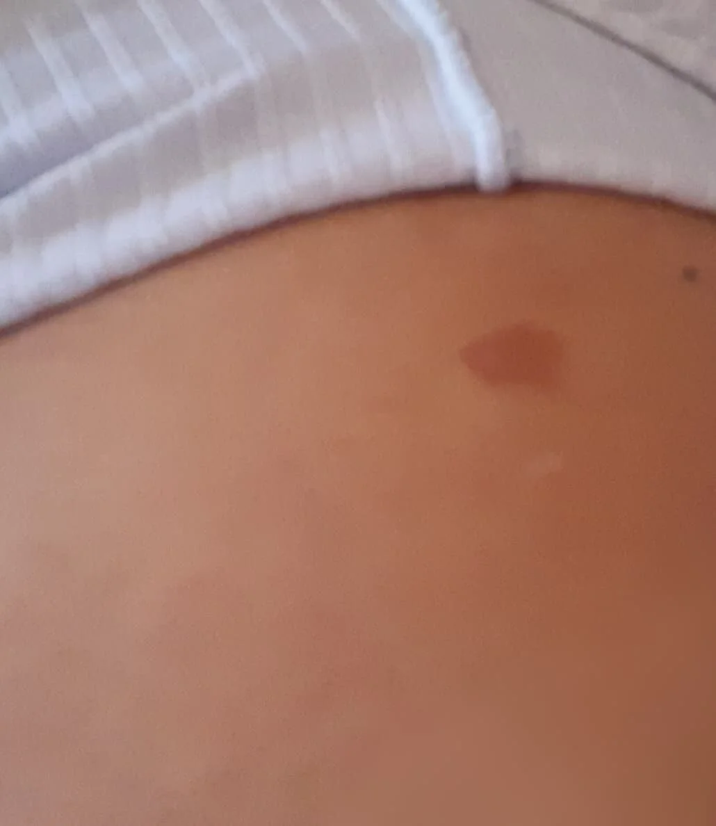 Uma cicatriz do passado
