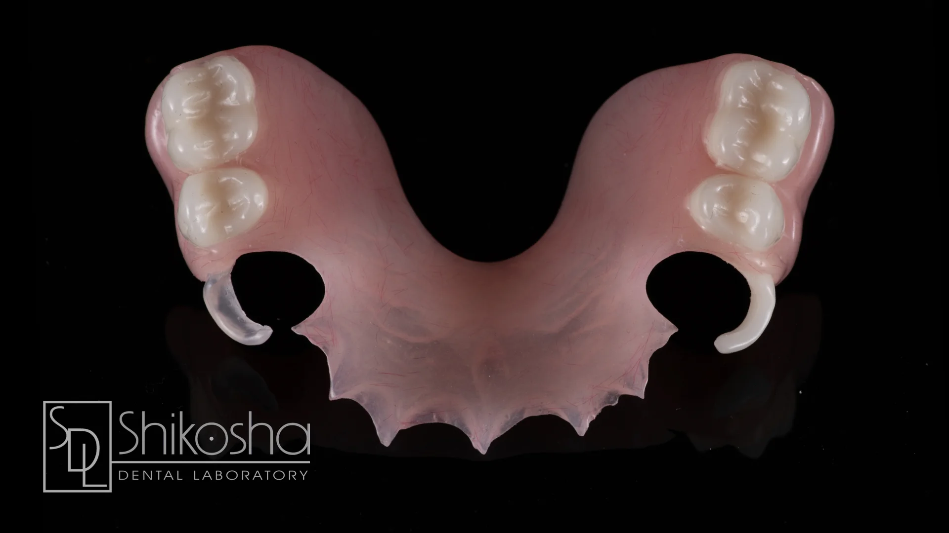 Dentures — Shikosha Dental Lab