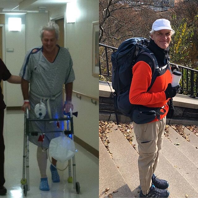 Come a long way since then. On the left 12/24/2009... on the right, 11/23/2019... #walktothepark #tkr #thankful