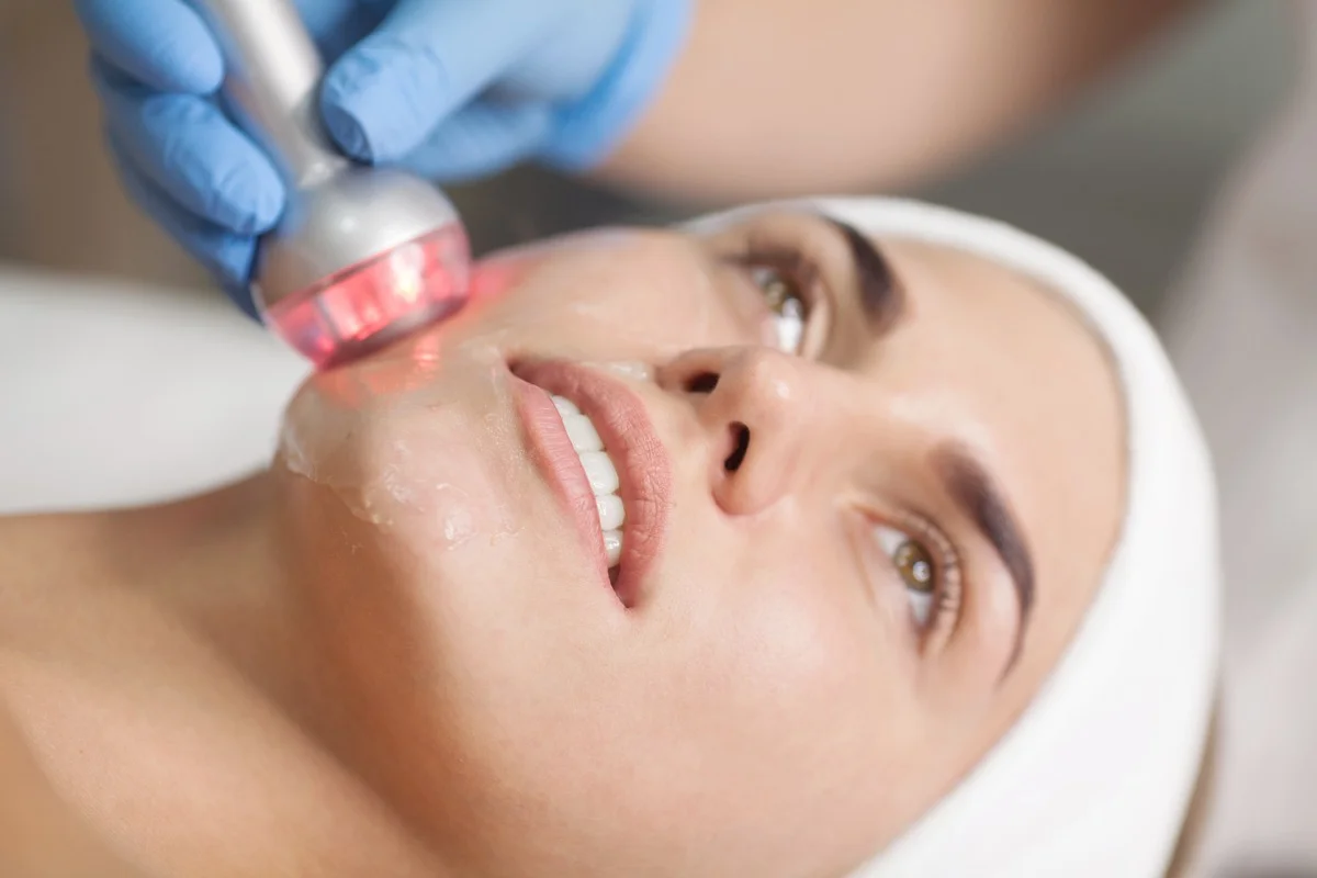 radio frequency skin tightening